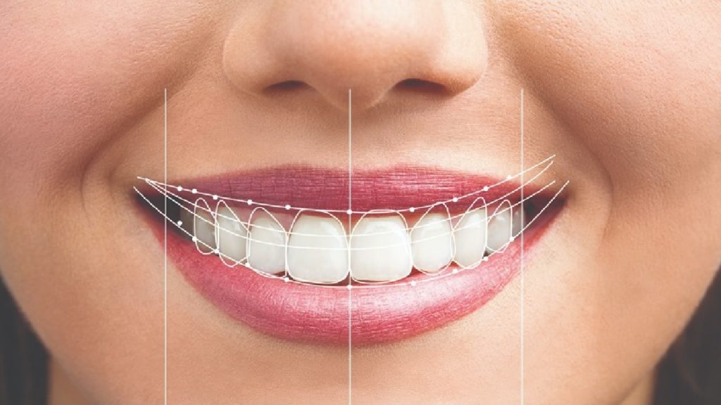 معیار های زیبایی لبخند