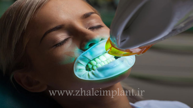 درمان زردی دندان