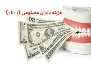 هزینه دندان مصنوعی