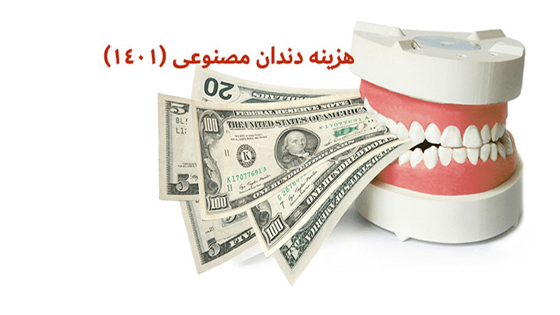 هزینه دندان مصنوعی