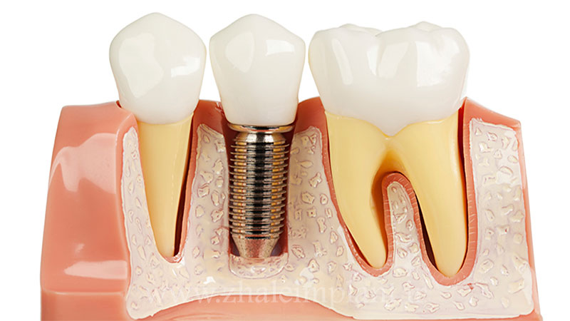 چه زمانی درد غیرطبیعی است؟