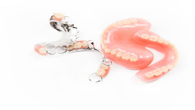 هزینه دندان مصنوعی کامل