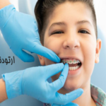 ارتودنسی پیشگیری