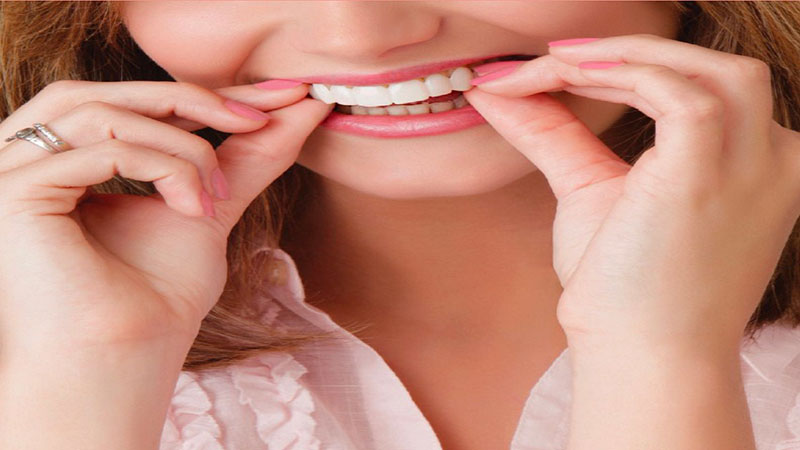 انواع لمینت متحرک دندان