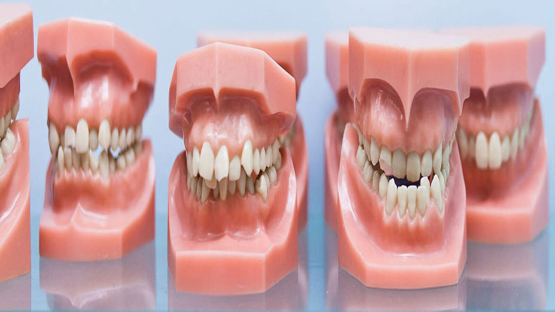 ناهنجاری های دندانی و فکی