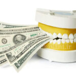 هزینه بلیچینگ دندان