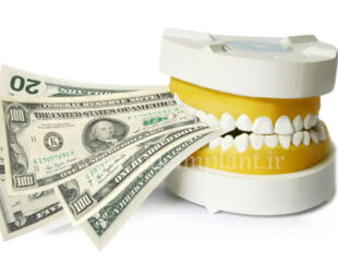 هزینه بلیچینگ دندان