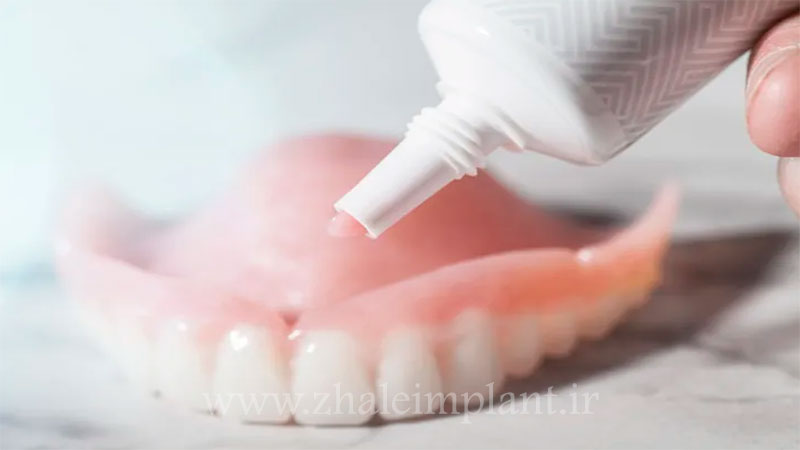 چسب دندان مصنوعی