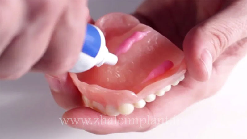 انواع چسب دندان مصنوعی
