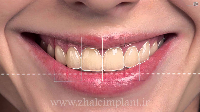 طراحی لبخند دیجیتال