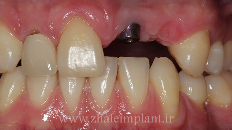 مشکلات پزشکی و استخوانی