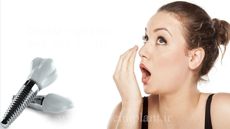 علت بوی بد دهان بعد از ایمپلنت دندان چیست؟
