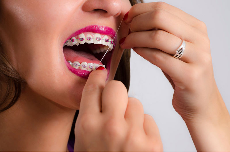 نخ دندان کشیدن