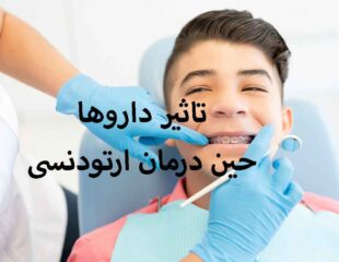 اثر داروها حین درمان ارتودنسی