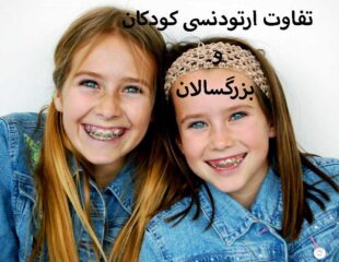 تفاوت ارتودنسی کودکان و بزرگسالان