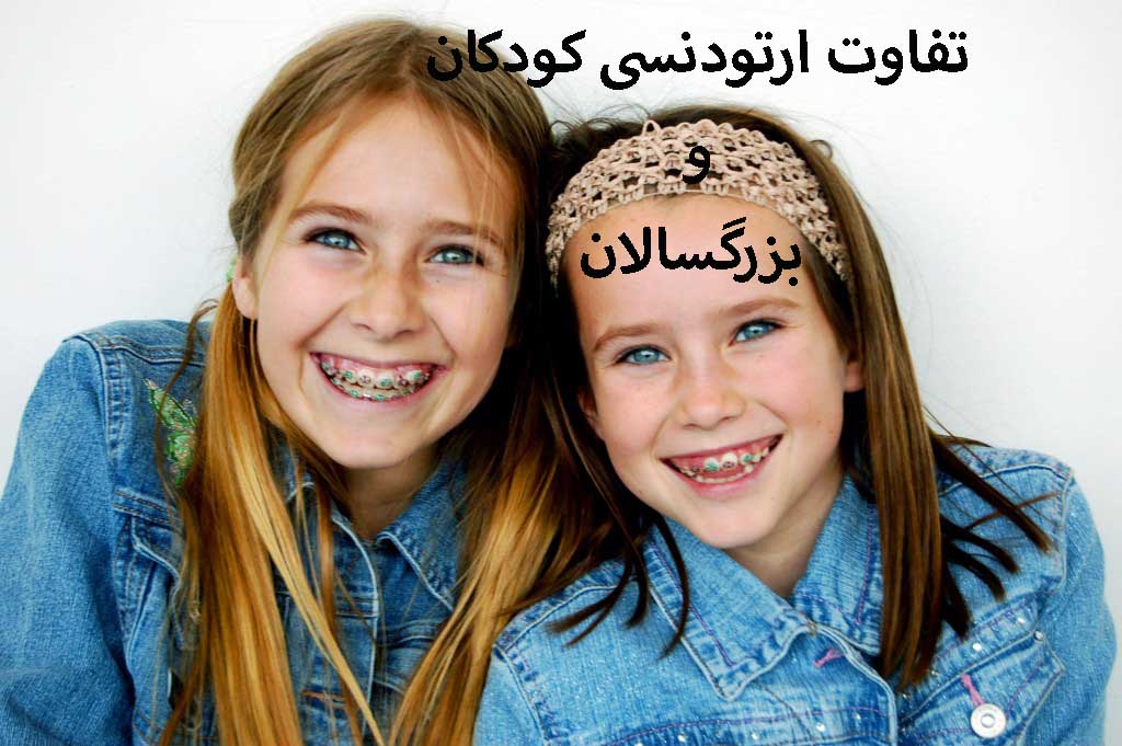 تفاوت ارتودنسی کودکان و بزرگسالان