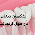 شکستن دندان در طول ارتودنسی