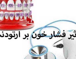تاثیر فشار خون بر ارتودنسی