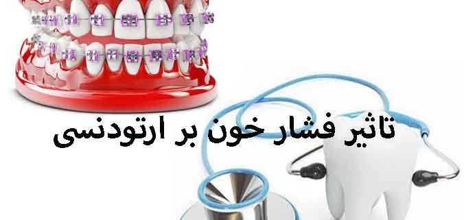 تاثیر فشار خون بر ارتودنسی