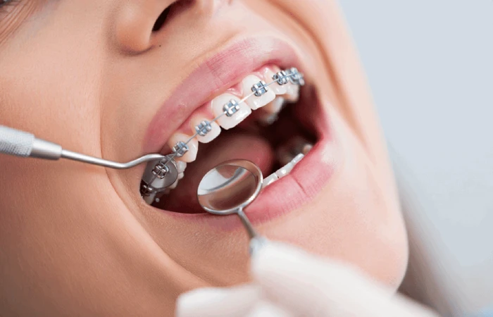 ارتودنسی دندان