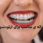 لثه ی مناسب برای ارتودنسی
